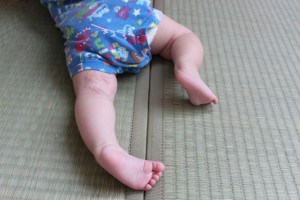 赤ちゃん　Ｏ脚